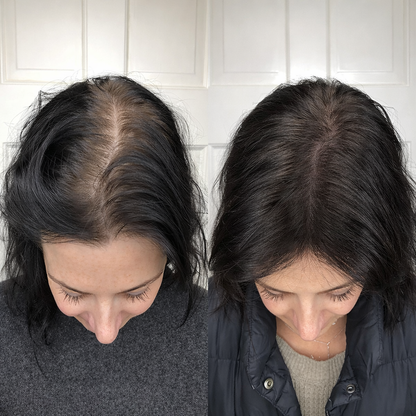 Youth Revival Ritual™ High Frequency Wand